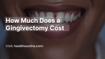 How Much Does a Gingivectomy Cost