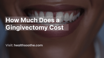 How Much Does A Gingivectomy Cost