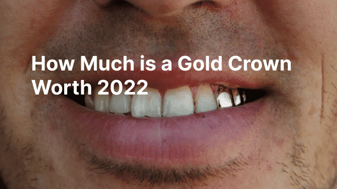 How Much Is A Gold Crown Worth 2022