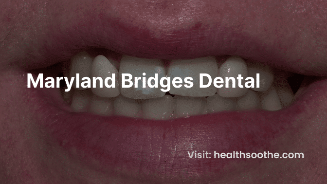 Maryland Bridges Dental