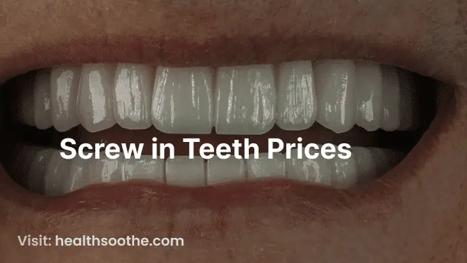 Screw in Teeth Prices