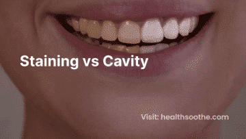 Staining Vs Cavity