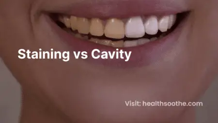 Staining vs Cavity