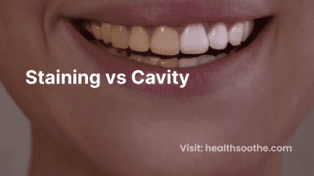 Staining vs Cavity