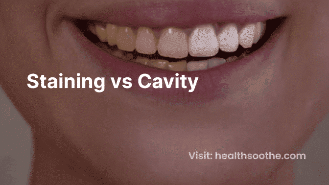 Staining vs Cavity