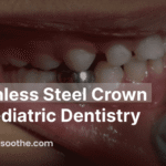 stainless steel crown in pediatric dentistry