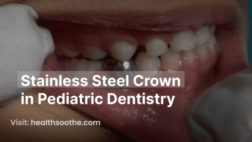 stainless steel crown in pediatric dentistry