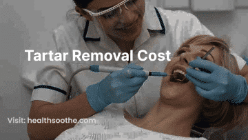 Tartar Removal Cost