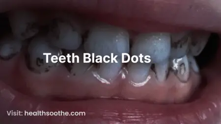 Teeth Black Dots