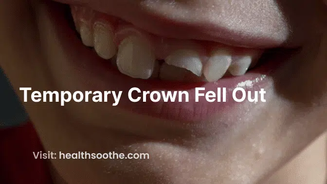 What to Do When Your Temporary Crown Falls Out: A Comprehensive Guide Temporary Crown Fell Out