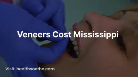Veneers Cost Mississippi