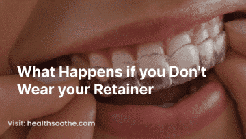 What Happens If You Don'T Wear Your Retainer