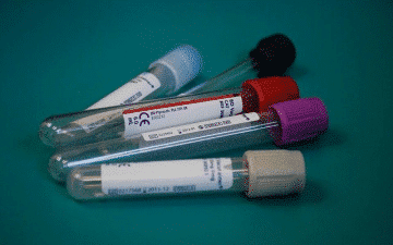The Role of Lab Labels in Compliance and Regulation