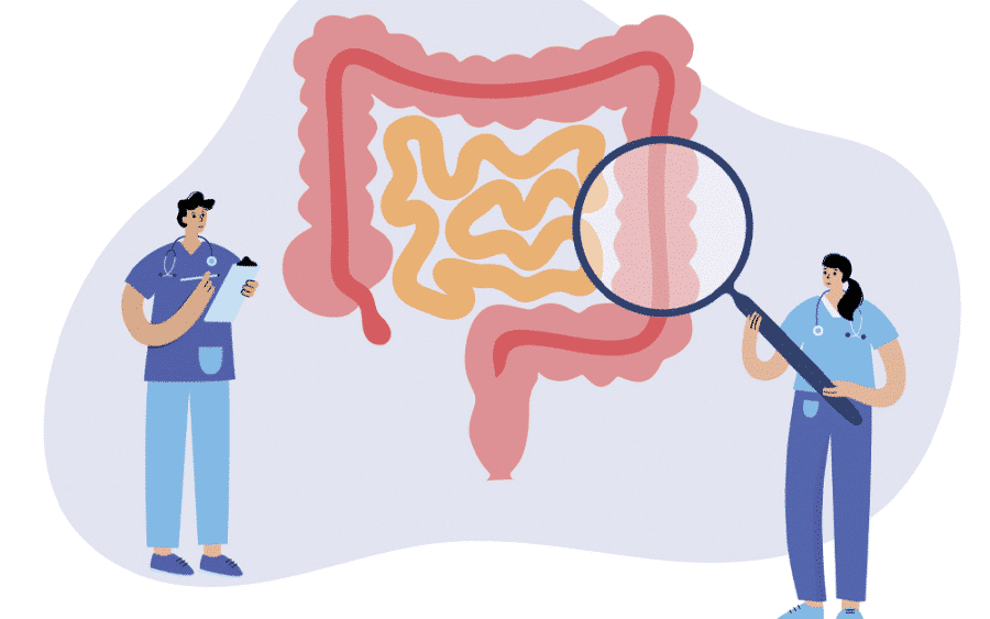 Bowel Cancer Screening Guide