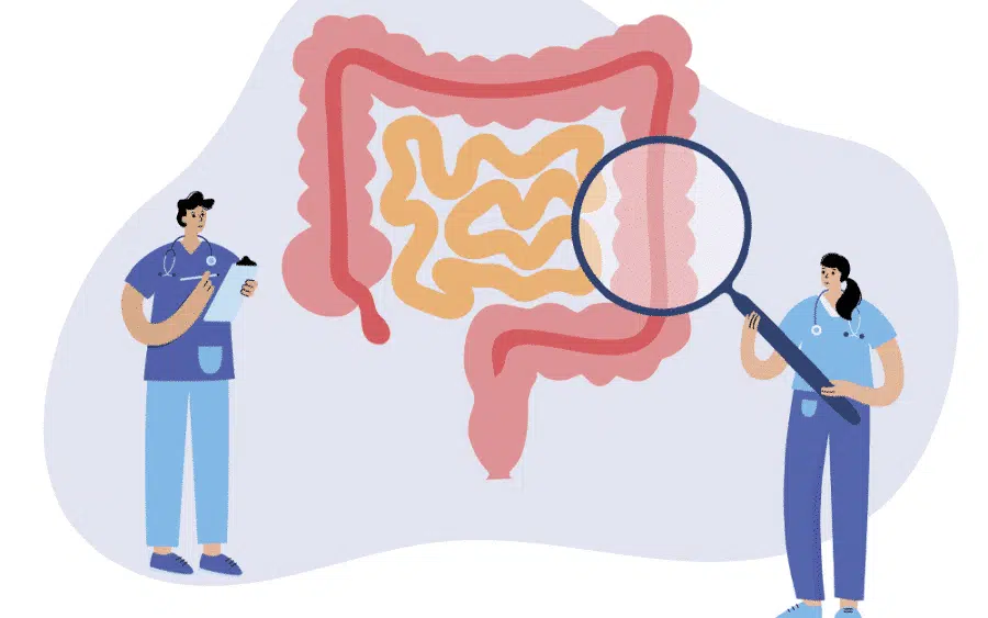 A Complete Guide to Bowel Cancer Screening: Taking Control of Your Health