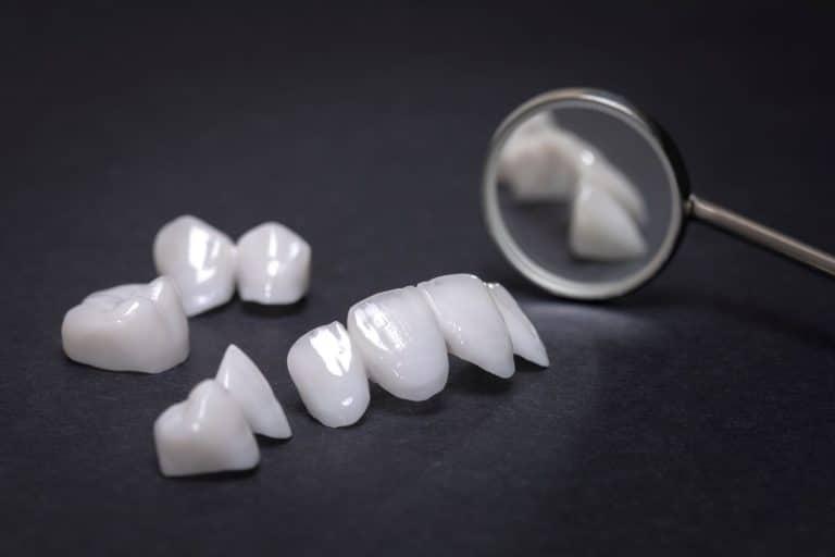How To Choose The Right Material For Dental Veneers