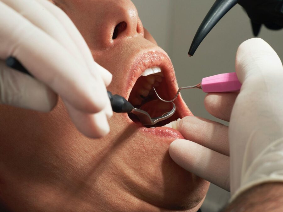 5 Surprising Health Problems Caused By Nocturnal Teeth Grinding