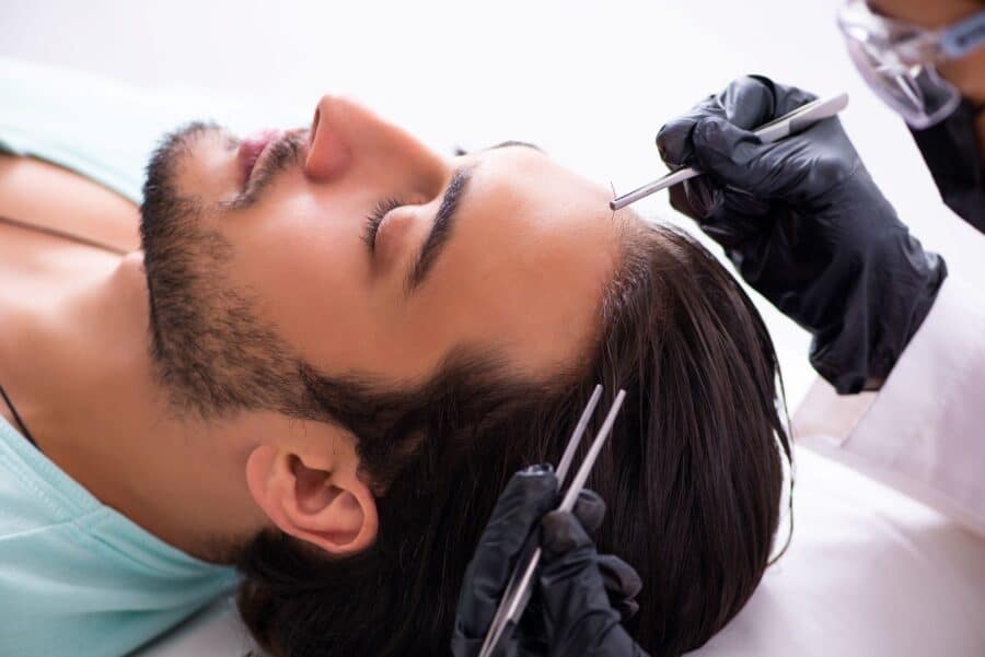 The Journey From Hair Loss To Transplant