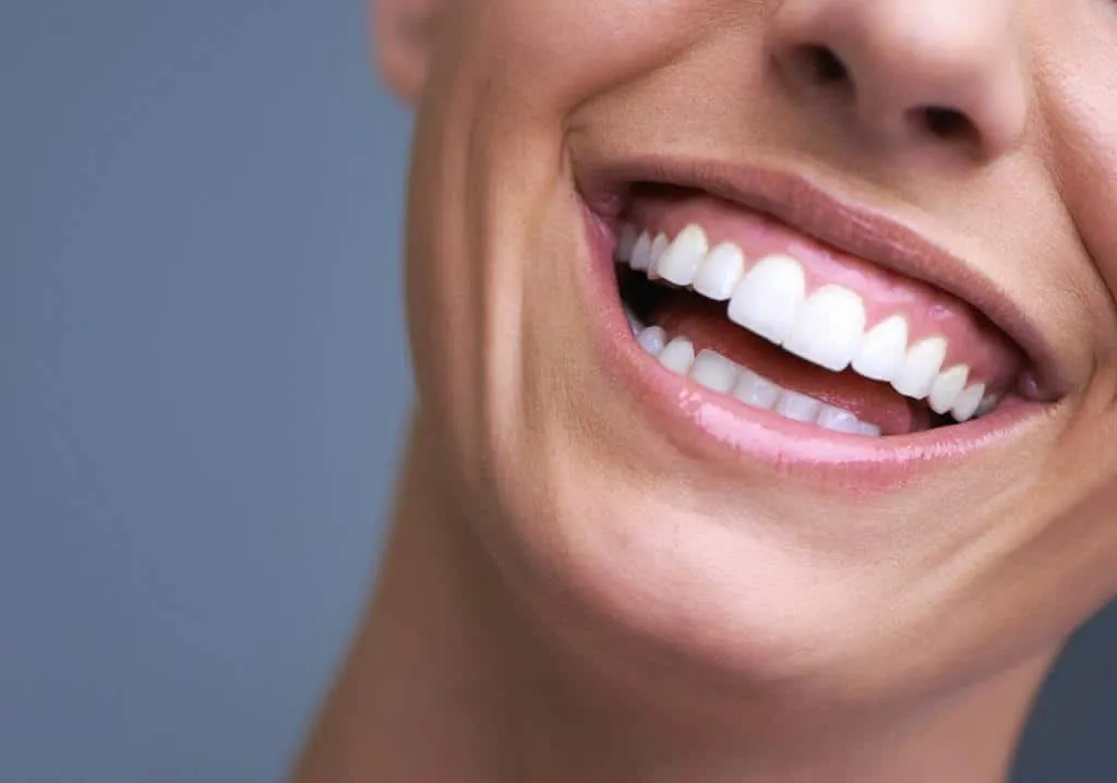 Smile Makeover – Premium Dental Center