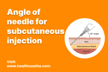 Angle Of Needle For Subcutaneous Injection