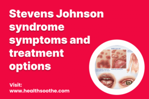 stevens johnson syndrome symptoms and treatment options