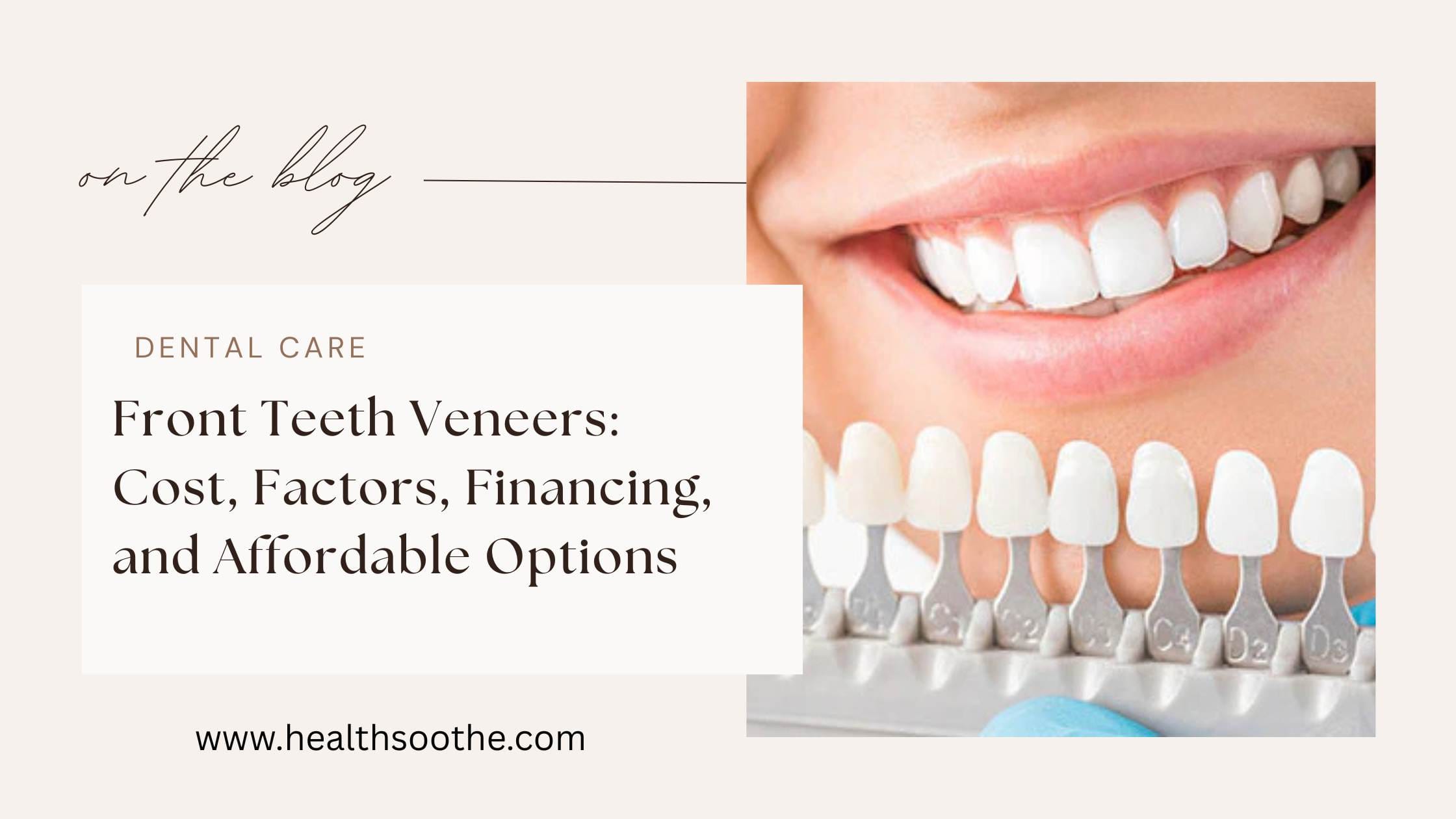 Front Teeth Veneers