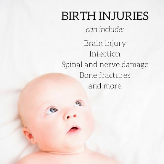 Birth injury