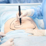 What to Expect During Your Visit to a Modern Colorectal Clinic 1 Colorectal Surgery 768x515 1