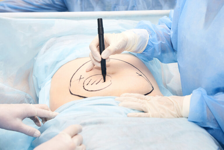 What to Expect During Your Visit to a Modern Colorectal Clinic 1 Colorectal Surgery 768x515 1