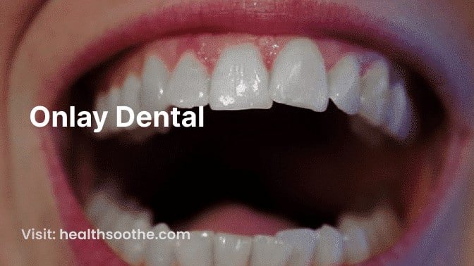 DENTAL INLAYS AND ONLAYS TREATMENT