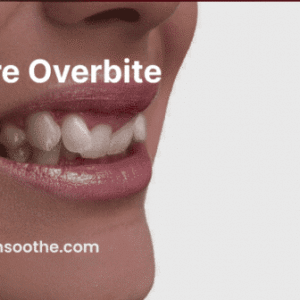 Understanding Severe Overbites: Causes, Effects & Treatment